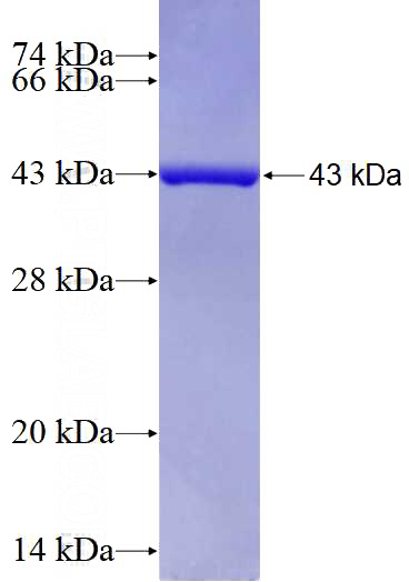Recombinant Human SSBP1 SDS-PAGE