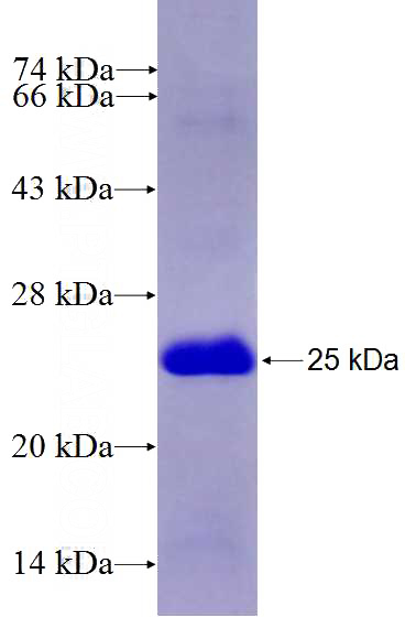 Recombinant Human ZEB2 SDS-PAGE