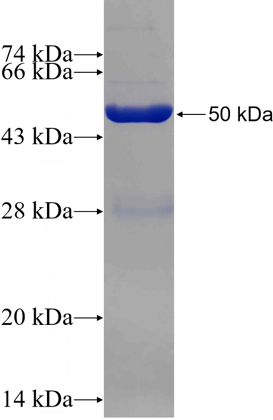 Recombinant Human NQO2 SDS-PAGE