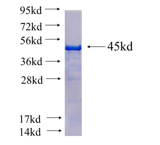 Recombinant human SH3D19 SDS-PAGE