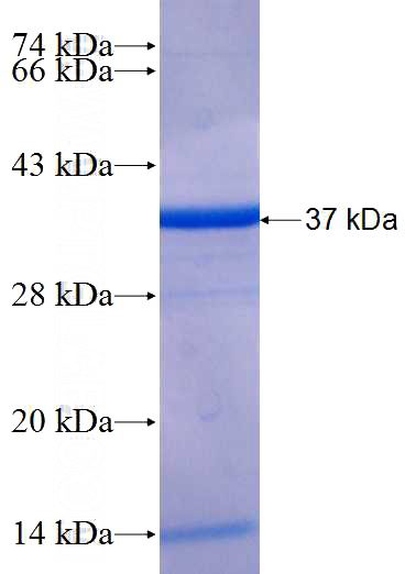 Recombinant Human CCDC90B SDS-PAGE