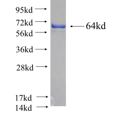 Recombinant human YTHDF1 SDS-PAGE
