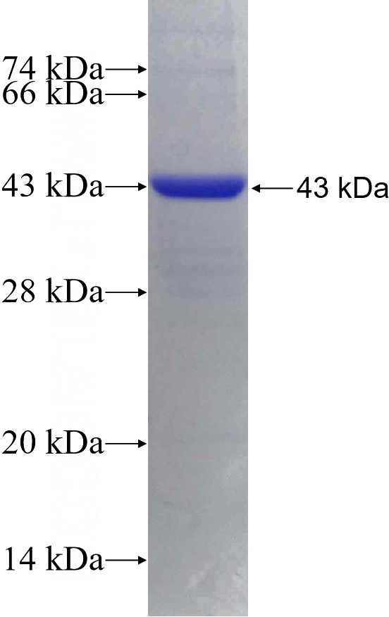 Recombinant Human DDO SDS-PAGE