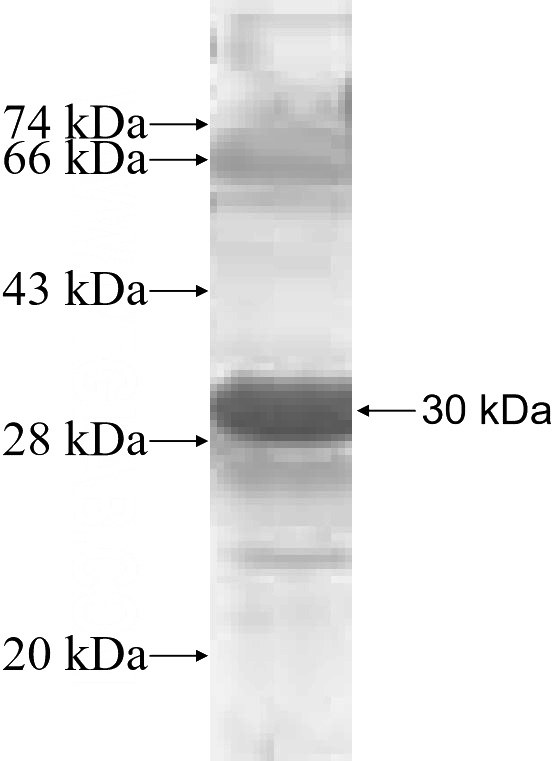 Recombinant Human MAGEA2 SDS-PAGE