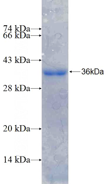 Recombinant Human SNAI2 SDS-PAGE