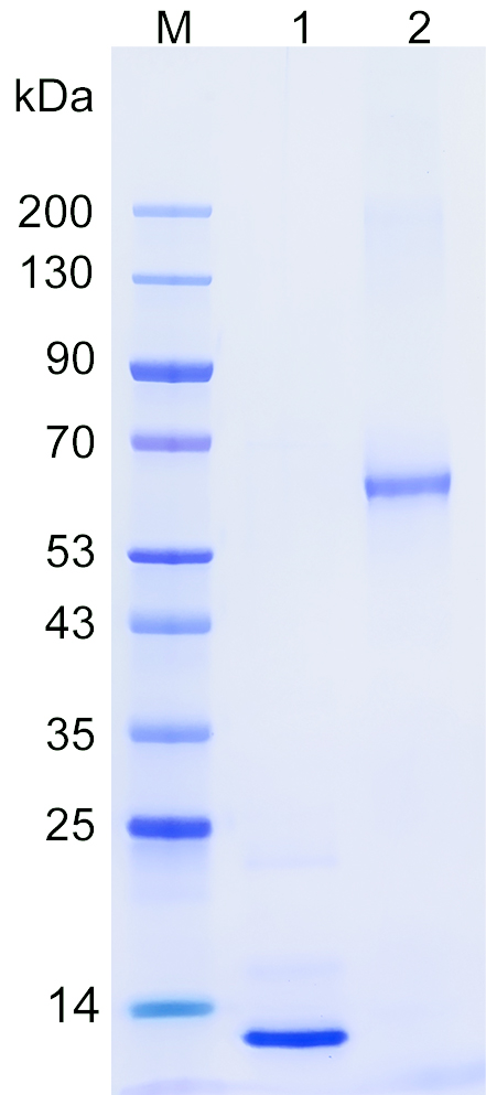 Recombinant ZBT7A protein (His tag) SDS-PAGE