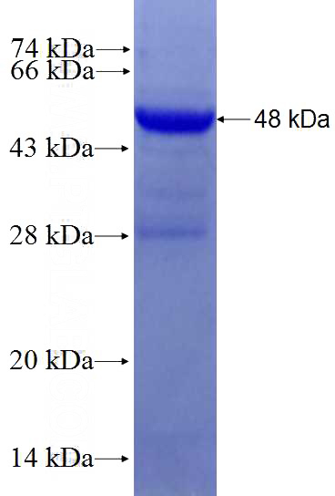Recombinant Human COQ3 SDS-PAGE
