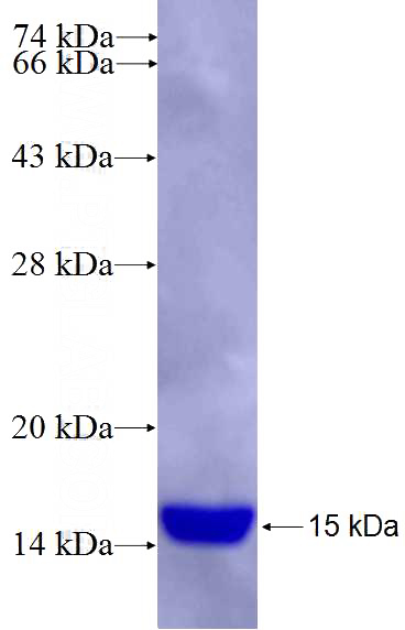 Recombinant Human FBXL2 SDS-PAGE