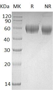 Human LUM/LDC/SLRR2D (His tag) recombinant protein