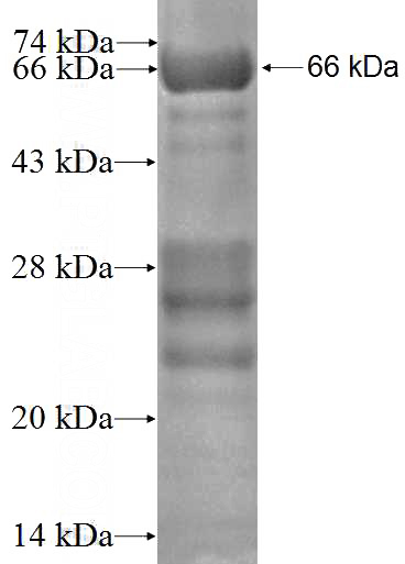 Recombinant Human PDE4DIP SDS-PAGE