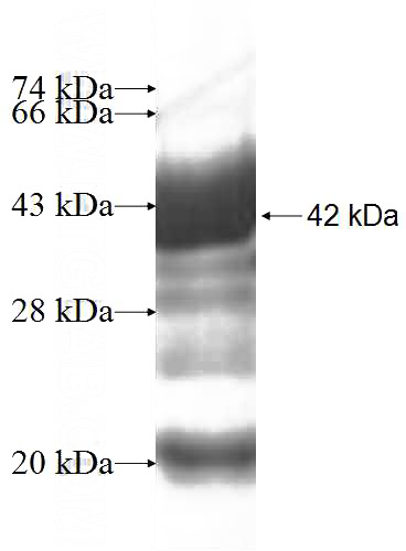 Recombinant Human UBXN6 SDS-PAGE