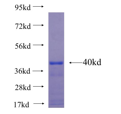Recombinant human LRP2BP SDS-PAGE