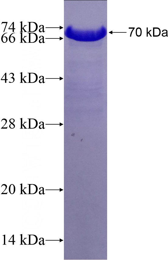 Recombinant Human RAD23A SDS-PAGE