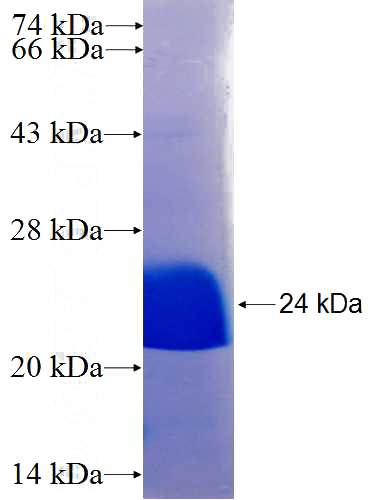 Recombinant Human SIPA1 SDS-PAGE