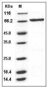 Human SGK3 / SGKL Protein (His & GST Tag) SDS-PAGE