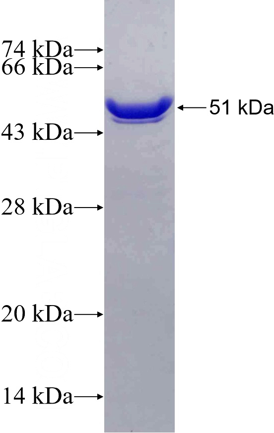 Recombinant Human TESC SDS-PAGE