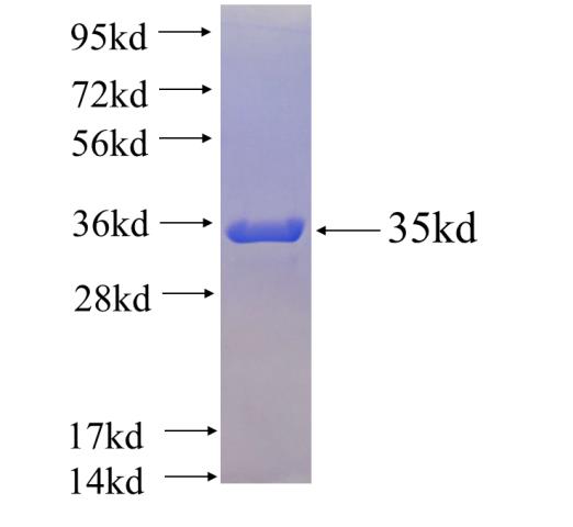 Recombinant human PLEKHG2 SDS-PAGE