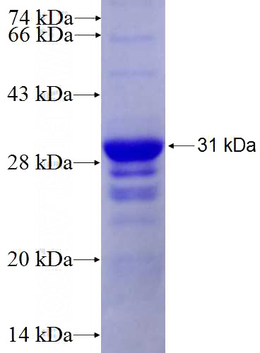 Recombinant Human NOL12 SDS-PAGE