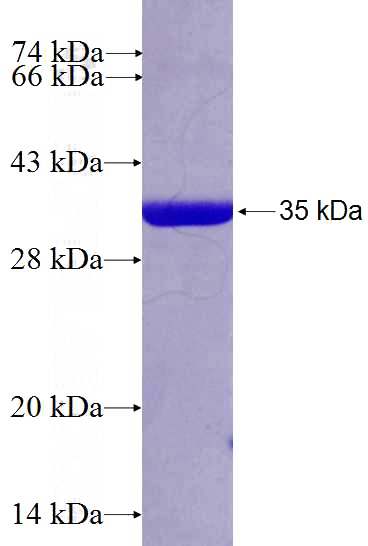 Recombinant Human RARRES1 SDS-PAGE