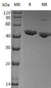 Human CHI3L1 (His tag) recombinant protein