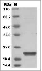 CETN2 protein SDS-PAGE