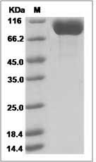 Human DPP4 / CD26 Protein (His Tag) SDS-PAGE