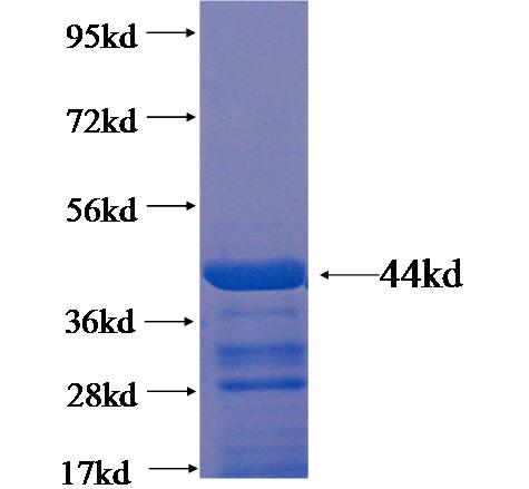 Recombinant human HACE1 SDS-PAGE