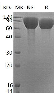 Human FLRT3/KIAA1469/UNQ856/PRO1865 (His tag) recombinant protein