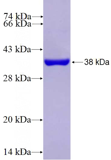 Recombinant Human CENPE SDS-PAGE