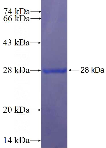 Recombinant Human BAIAP2L1 SDS-PAGE