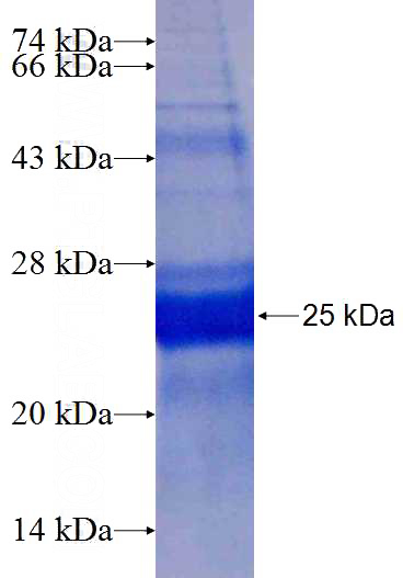 Recombinant Human SEMA3B SDS-PAGE
