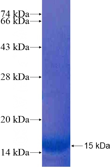 Recombinant Human APOBEC3D SDS-PAGE