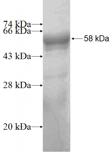 Recombinant Human PKD2L1 SDS-PAGE
