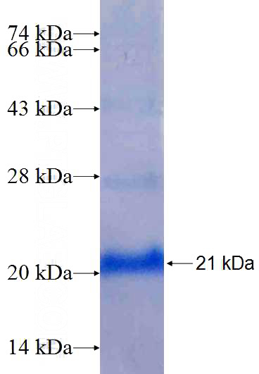 Recombinant Human BTG1 SDS-PAGE