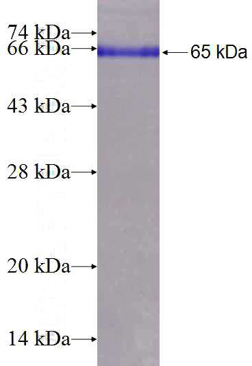 Recombinant Human PDPK1 SDS-PAGE