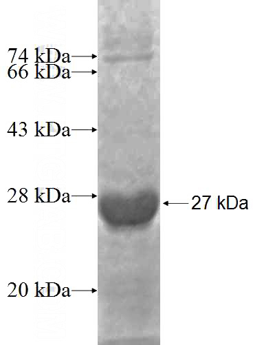 Recombinant Human RAP1A SDS-PAGE