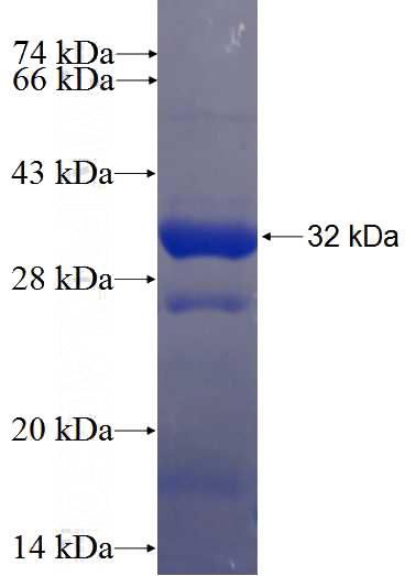 Recombinant Human RBCK1 SDS-PAGE
