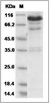 Mouse HGF / Hepatocyte Growth Factor Protein (His Tag) SDS-PAGE
