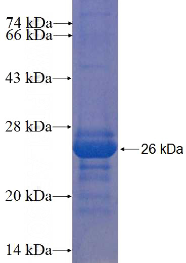 Recombinant Human KIAA0247 SDS-PAGE