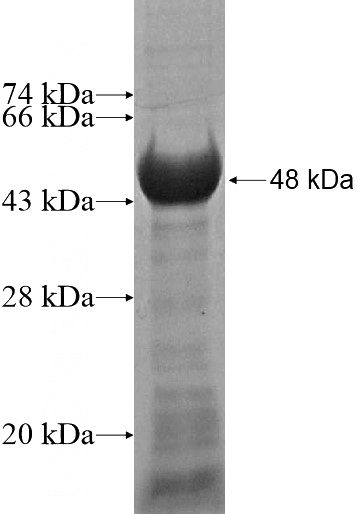 Recombinant Human KIAA0644 SDS-PAGE