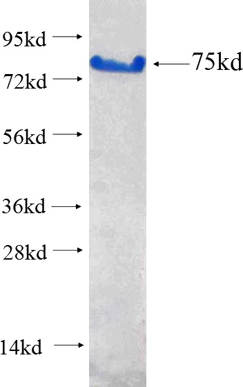Recombinant Human RIC3 SDS-PAGE