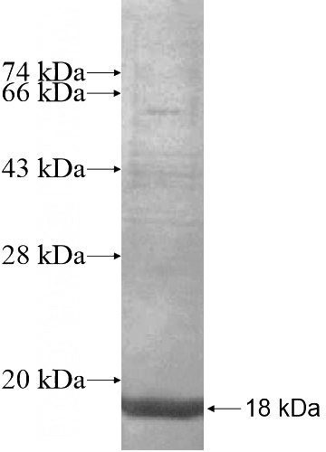 Recombinant Human KLHDC8B SDS-PAGE