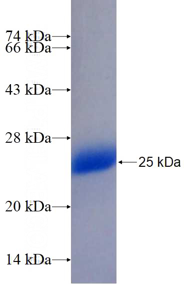 Recombinant Human BTG4 SDS-PAGE