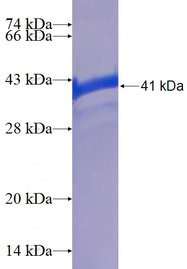 Recombinant Human SAMD8 SDS-PAGE