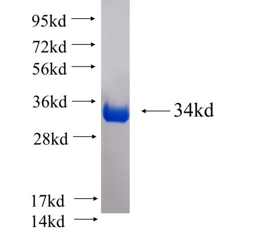 Recombinant human EHD1 SDS-PAGE