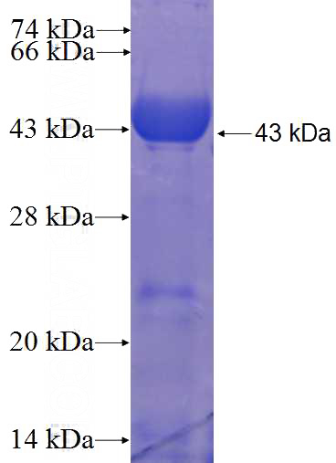 Recombinant Human CTNNA1 SDS-PAGE