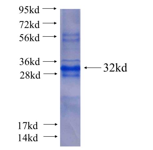 Recombinant human ASB17(Full length) SDS-PAGE