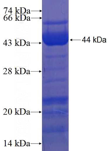 Recombinant Human AZI1 SDS-PAGE