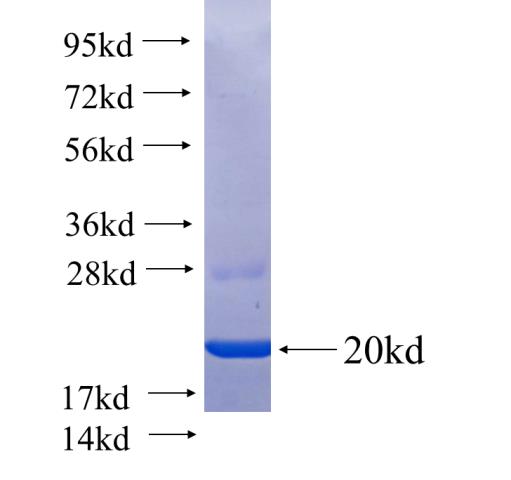 Recombinant human REEP5(Full length) SDS-PAGE