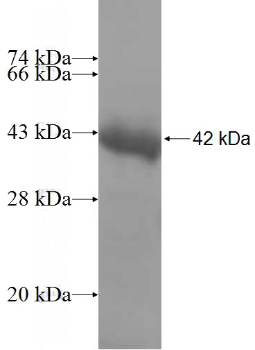 Recombinant Human PITPNC1 SDS-PAGE